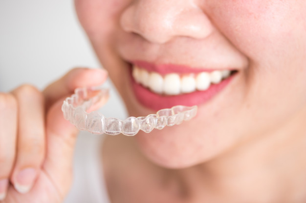 Dental braces can involve metal/ceramic brackets or clear aligners such as Invisalign. Orthodontic appliances such as headgear or rapid palatal expander can be used in a growing child to modify the growth of the jaw.
